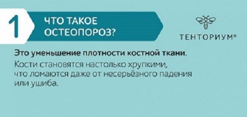 Что такое